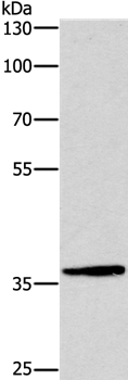 DUSP2