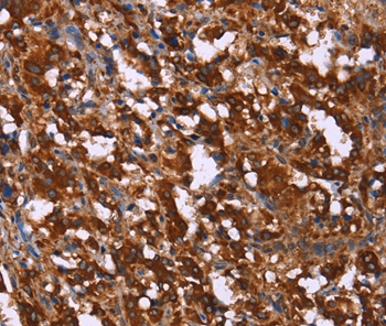 Rabbit Polyclonal Antibody to GAGE7