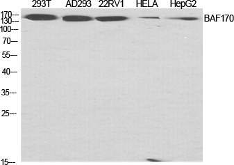 Rabbit Polyclonal Antibody to BAF170
