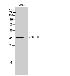 C/EBP β