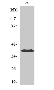 CCRL1