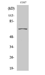 CEP70