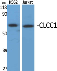 Rabbit Polyclonal Antibody to CLCC1