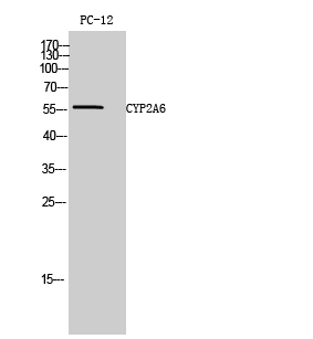 CYP2A6