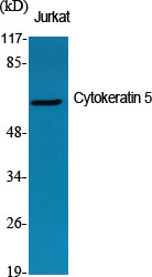 Rabbit Polyclonal Antibody to Cytokeratin 5