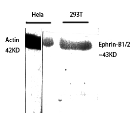 Rabbit Polyclonal Antibody to Ephrin-B1/2