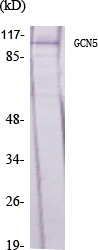 Rabbit Polyclonal Antibody to GCN5