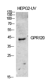 Rabbit Polyclonal Antibody to GPR120