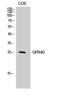 GPR40