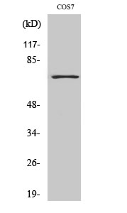 Histone deacetylase 10