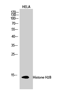 Histone H2B