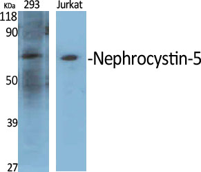 Rabbit Polyclonal Antibody to Nephrocystin-5
