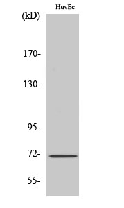 NF2