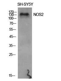 Rabbit Polyclonal Antibody to NOS2