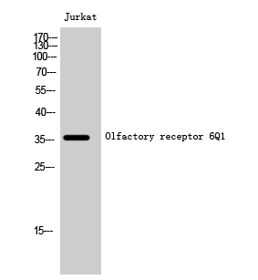 Olfactory receptor 6Q1