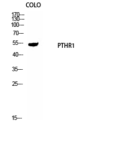 PTH/PTHrP-R