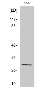 Ribosomal Protein S8