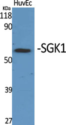 Rabbit Polyclonal Antibody to SGK1