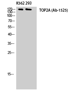 Topo IIα