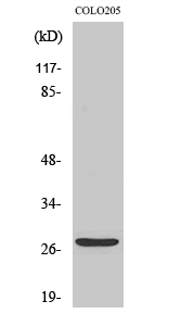 TP53INP1