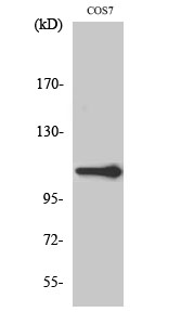 XRN2