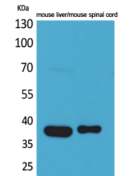 Aldolase C