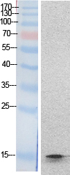 Histone H2B