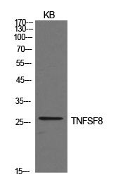 Rabbit Polyclonal Antibody to CD30-L