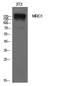 Rabbit Polyclonal Antibody to CD206