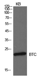 Rabbit Polyclonal Antibody to Probetacellulin