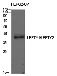 Rabbit Polyclonal Antibody to Lefty
