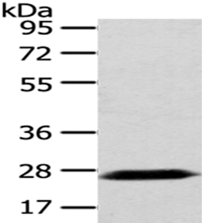 PDZK1