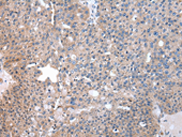 Rabbit Polyclonal Antibody to SND1