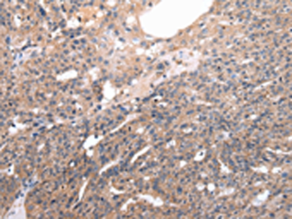 Rabbit Polyclonal Antibody to M6PR