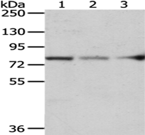 ACSS2