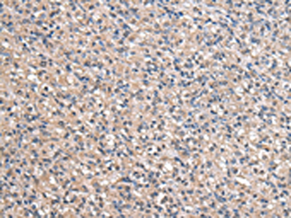 Rabbit Polyclonal Antibody to ACSS2