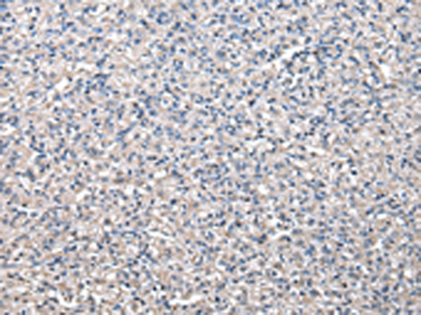 Rabbit Polyclonal Antibody to CCT5