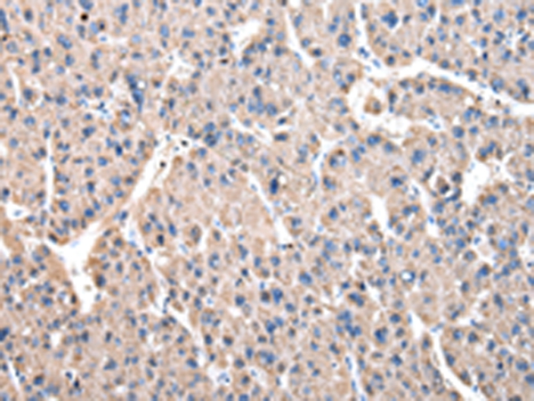 Rabbit Polyclonal Antibody to DARS