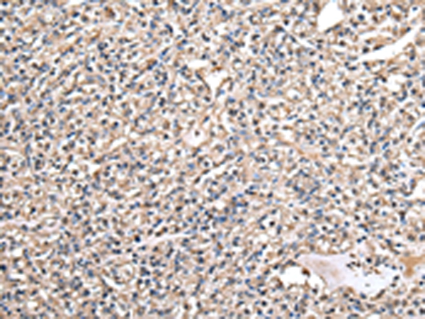 Rabbit Polyclonal Antibody to DARS