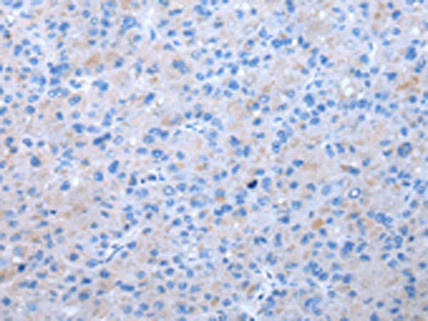 Rabbit Polyclonal Antibody to EIF3I