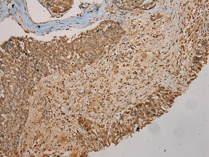 Rabbit Polyclonal Antibody to GALE