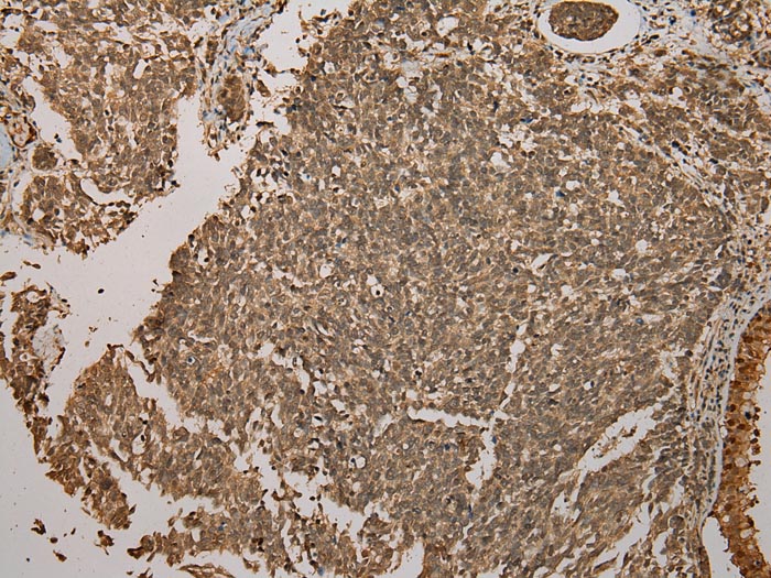 Rabbit Polyclonal Antibody to GALE