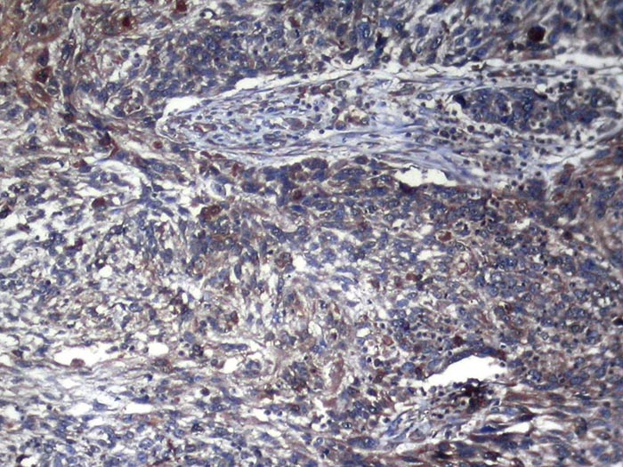 Rabbit Polyclonal Antibody to GAMT
