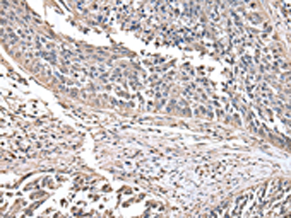 Rabbit Polyclonal Antibody to HAGH
