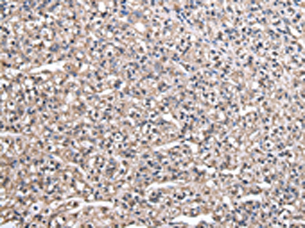 Rabbit Polyclonal Antibody to HAGH