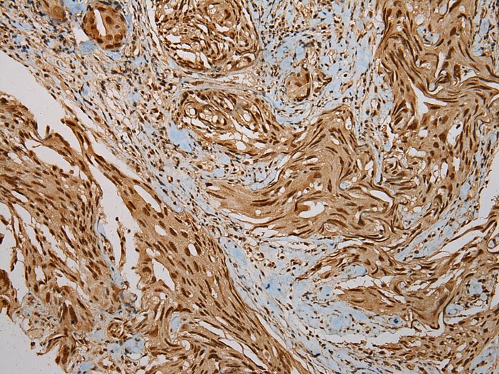 Rabbit Polyclonal Antibody to PUF6