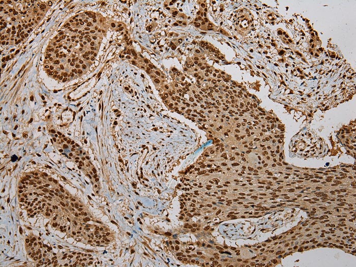 Rabbit Polyclonal Antibody to PUF6