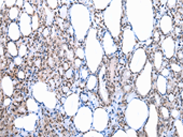 Rabbit Polyclonal Antibody to SETMAR