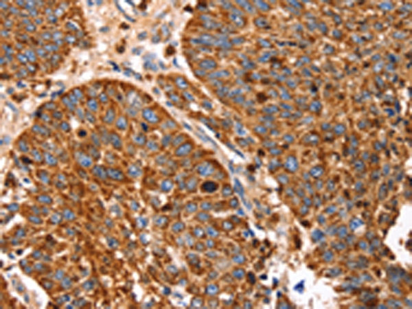 Rabbit Polyclonal Antibody to SLC27A5