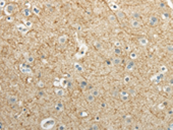 Rabbit Polyclonal Antibody to WNT2